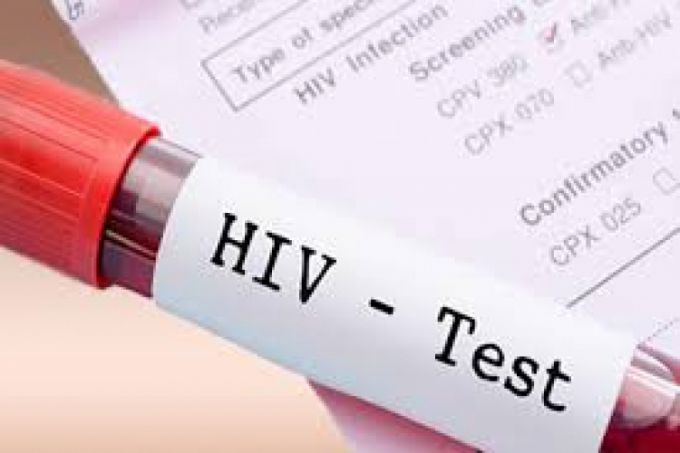 În primele zece luni ale anului curent, аu fost confirmate 742 de cazuri noi cu HIV