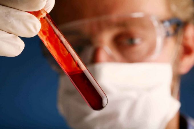 O nouă analiză de sânge poate detecta până la 90% dintre cazurile de endometrioză