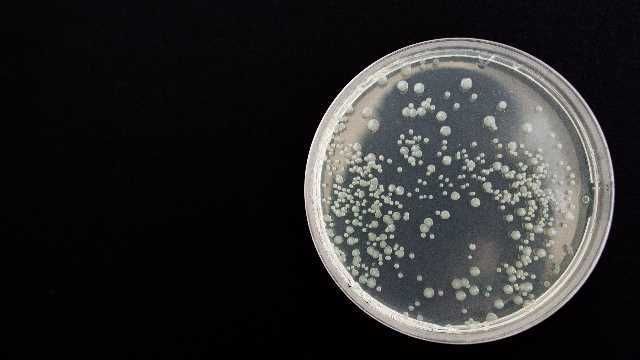 Rezultatele investigaţiilor presupusei intoxicaţiei de Orizont: La 13 angajaţi s-a depistat Staphylococcus aureus