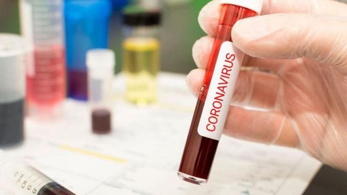 Coronavirus: Un studiu relevă că 82% dintre pacienţii cu COVID-19 au deficienţă de vitamina D
