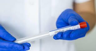 Testele gratuite pentru depistarea COVID-19 vor începe în Cehia pe 18 decembrie
