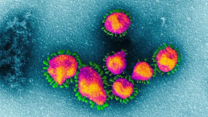 Coronavirus a ajuns în două noi state europene. Austria şi Croaţia au înregistrat primele cazuri de COVID-19
