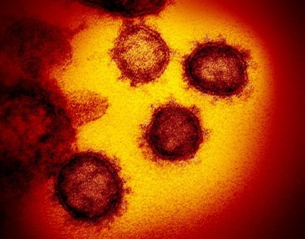 FOTO. Cum arată coronavirusul la microscop. Cercetătorii au publicat primele imagini