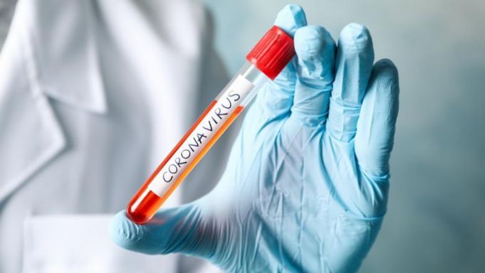 Coronavirus: Alte 171 de cazuri confirmate astăzi în R. Moldova