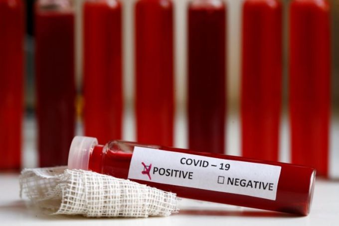 Coronavirus România. Încă o zi cu creştere alarmantă a cazurilor noi de infectare. 21 de persoane au murit în 24 de ore