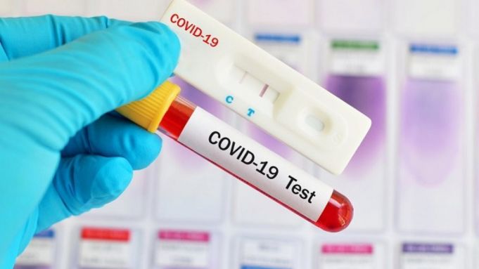 249 cazuri noi de COVID-19, înregistrate în ultimele 24 ore