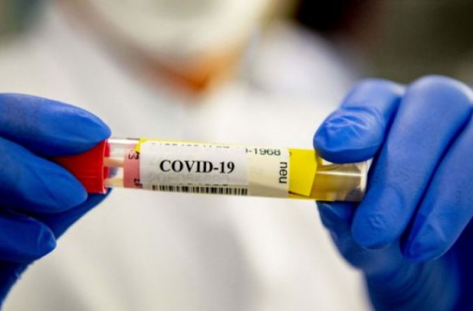 Alte 406 cazuri noi de infectare cu COVID-19 şi cinci decese, confirmate astăzi în Republica Moldova