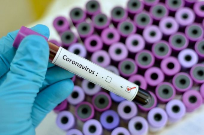 Coronavirus: Peste 10.000 de noi cazuri în ultimele 24 de ore în Franţa