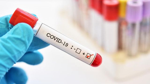 Un nou lot de 100 mii de teste pentru depistarea COVID-19 va fi achiziţionat în scurt timp de R. Moldova