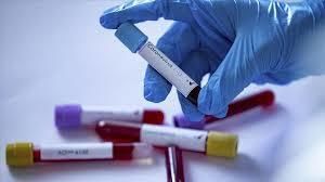 Coronavirus România. Continuă să scadă numărul cazurilor noi. Rata de infectare în ultimele 24 de ore este de 10,7%