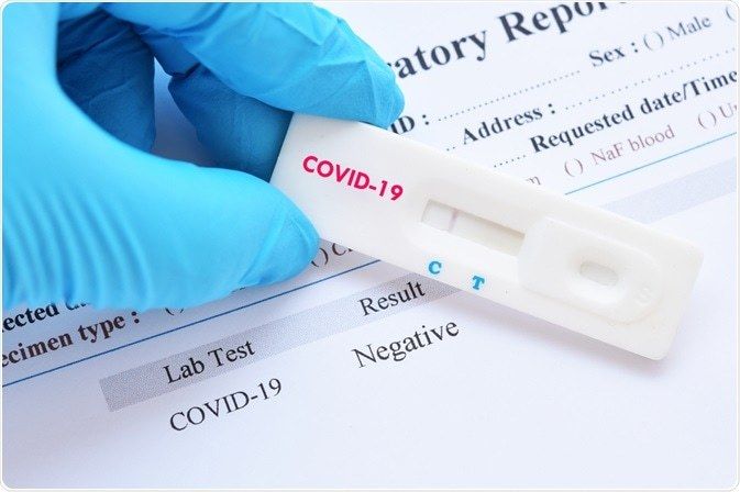 371 cazuri de COVID-19, înregistrate în ultimele 24 de ore