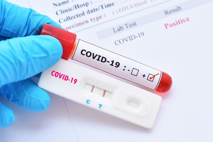 Coronavirus România. Rata de infectare creşte la 14,5%. La Terapie Intensivă sunt 971 de pacienţi