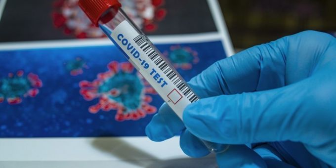 Coronavirus România. Numărul cazurilor noi de infectare rămâne ridicat. Creşte numărul pacienţilor în stare gravă