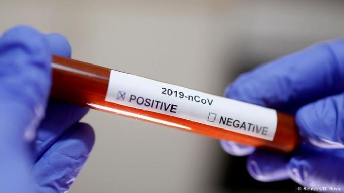 Coronavirus România. 63 de cazuri noi, raportate în ultimele 24 de ore
