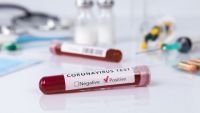România: Aproape 19.000 de cazuri noi de coronavirus în ultimele 24 de ore. Un test din patru efectuate a ieşit pozitiv