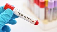 Alte 1 720 de cazuri de COVID-19, raportate în R. Moldova