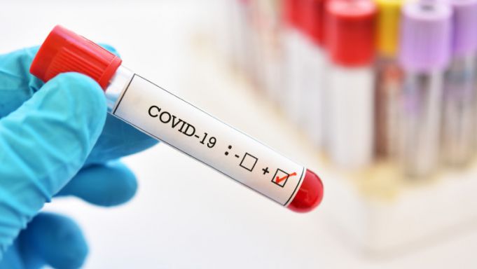COVID-19 România: 7.687 de cazuri noi de infectare şi 66 de decese, în ultimele 24 de ore