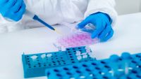 Testele de diagnostic PCR pentru COVID-19, cu tariful de 300 de lei, pot fi efectuate în trei laboratoare din Chişinău şi cinci din raioanele R. Moldova. Precizările Ministerului Sănătăţii