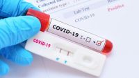 23 de cazuri noi de COVID-19, raportate în R. Moldova